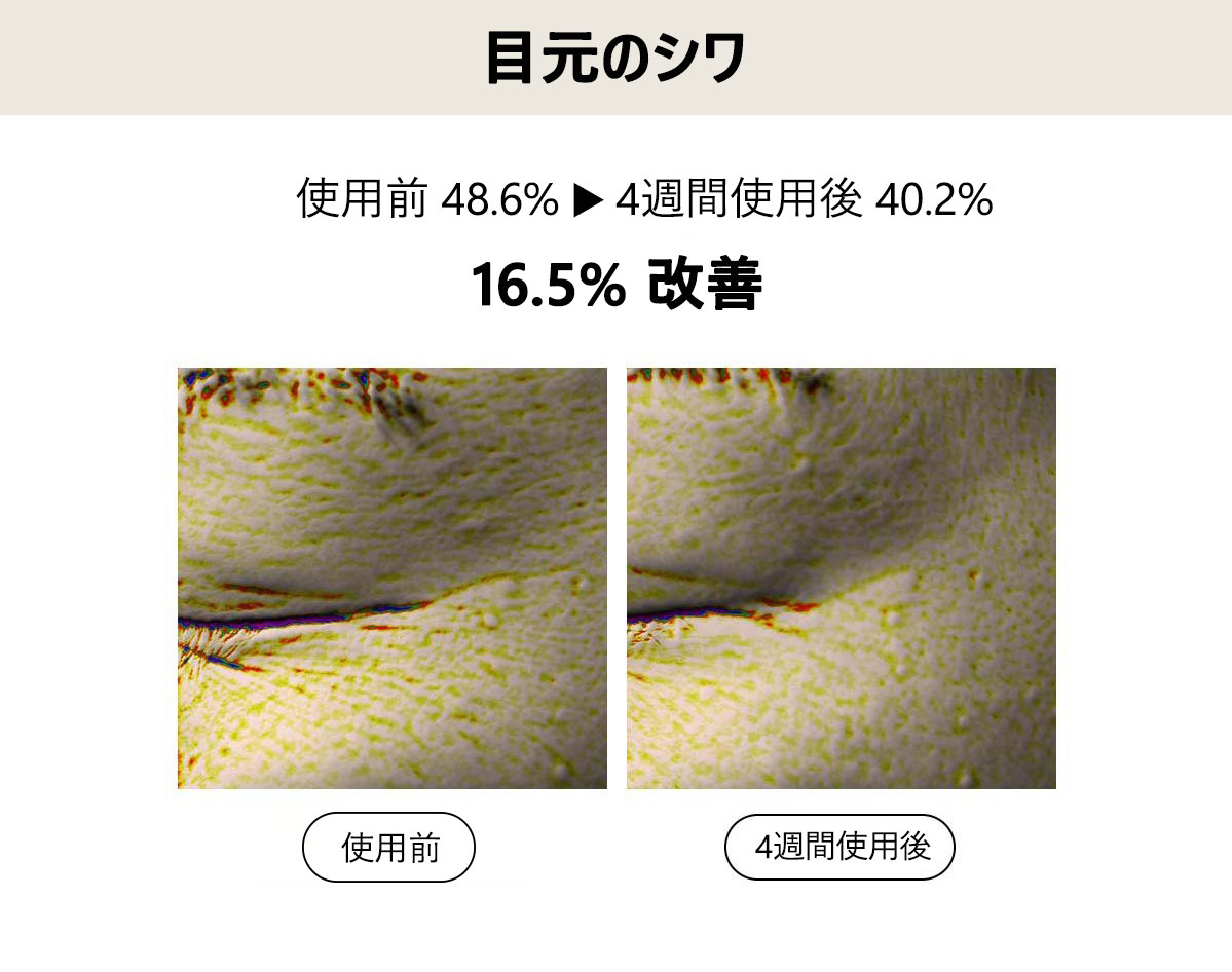 目元のシワ
使用前48.6% → 4週間使用後　40.2% 16.5%改善
使用前4週間使用後